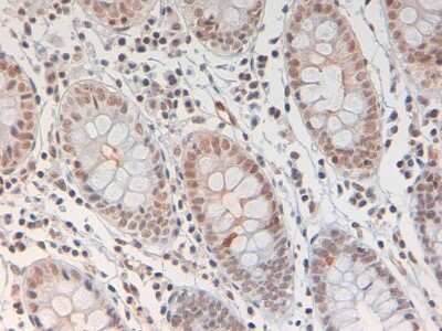 Immunohistochemistry-Paraffin: STAT3 [p Tyr705] Antibody [NBP2-19129]